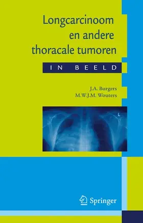 Burgers / Wouters | Longcarcinoom En Andere Thoracale Tumoren in Beeld | Buch | 978-90-313-6261-5 | www.sack.de