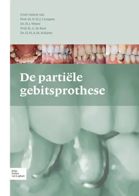 Creugers / Keltjens / Witter |  de Partiële Gebitsprothese | Buch |  Sack Fachmedien