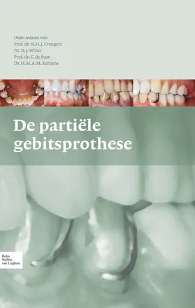 Creugers / Keltjens / Witter |  De partiële gebitsprothese | eBook | Sack Fachmedien