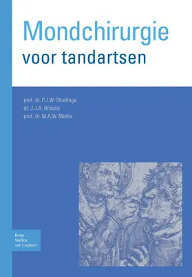 Stoelinga / Brouns / Merkx |  Mondchirurgie voor tandartsen | eBook | Sack Fachmedien