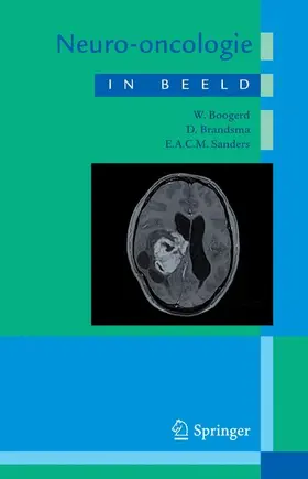 Boogerd / Sanders |  Neuro-oncologie in beeld | Buch |  Sack Fachmedien
