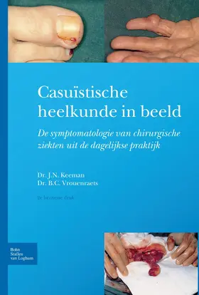 Keeman / Vrouenraets |  Casuïstische heelkunde in beeld | eBook | Sack Fachmedien