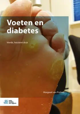 van Putten |  Voeten en diabetes | eBook | Sack Fachmedien