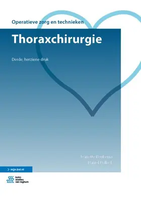 Beukema / Pollack |  Thoraxchirurgie | Buch |  Sack Fachmedien