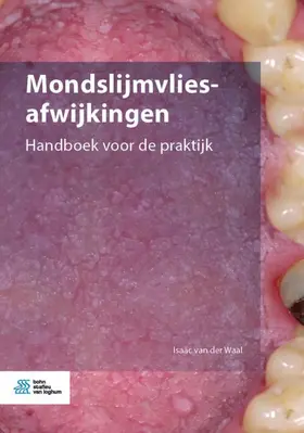 van der Waal | Mondslijmvliesafwijkingen | Buch | 978-90-368-2401-9 | www.sack.de