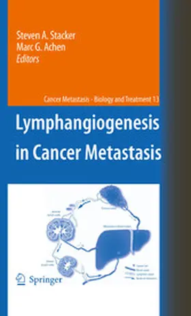 Stacker / Achen | Lymphangiogenesis in Cancer Metastasis | E-Book | www.sack.de