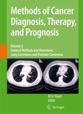 Hayat |  Methods of Cancer Diagnosis, Therapy and Prognosis | Buch |  Sack Fachmedien