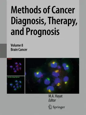 Hayat |  Methods of Cancer Diagnosis, Therapy, and Prognosis | Buch |  Sack Fachmedien