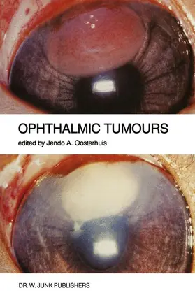 Oosterhuis |  Ophthalmic Tumours | Buch |  Sack Fachmedien