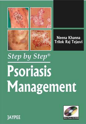 Khanna | Step by Step: Psoriasis Management | Buch | 978-93-5025-126-3 | sack.de
