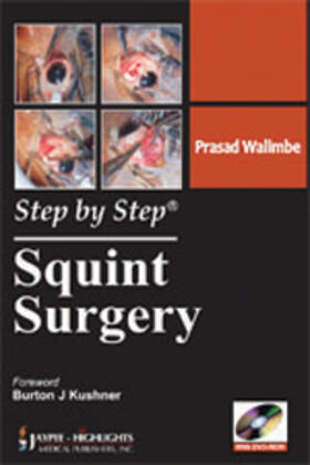 Walimbe | Step by Step: Squint Surgery | Buch | 978-93-5025-196-6 | sack.de
