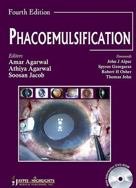 Agarwal / Jacob | Phacoemulsification, Fourth Edition | Buch | 978-93-5025-483-7 | sack.de