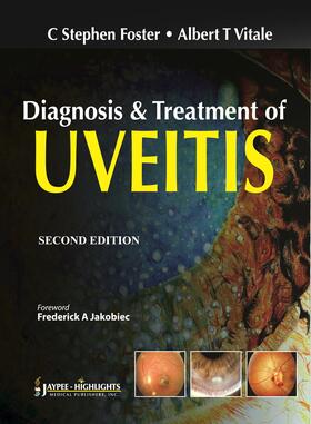 Foster / Vitale |  Diagnosis & Treatment of Uveitis | Buch |  Sack Fachmedien