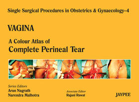 Nagrath / Malhotra / Rawat |  Single Surgical Procedures in Obstetrics and Gynaecology - Volume 4 - VAGINA | Buch |  Sack Fachmedien