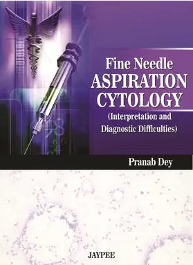 Dey |  Fine Needle Aspiration Cytology Interpretation and Diagnostic Difficulties | Buch |  Sack Fachmedien