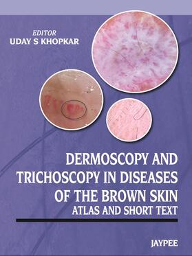 Khopkar |  Dermoscopy and Trichoscopy in Diseases of the Brown Skin | Buch |  Sack Fachmedien