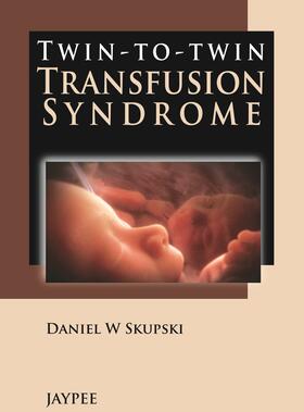 Skupski | Skupski, D: Twin-to-Twin Transfusion Syndrome | Buch | 978-93-5090-351-3 | sack.de