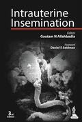Allahbadia / Merchant |  Intrauterine Insemination | Buch |  Sack Fachmedien