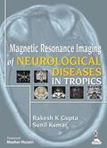 Gupta / Kumar |  Magnetic Resonance Imaging of Neurological Diseases in Tropics | Buch |  Sack Fachmedien