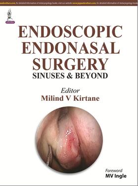 Kirtane | Endoscopic Endonasal Surgery | Buch | sack.de