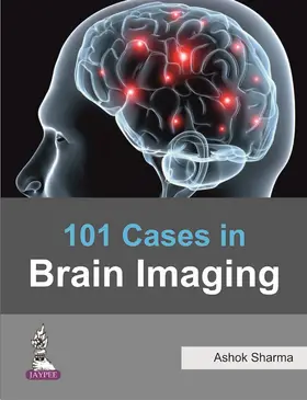 Sharma | 101 Cases in Brain Imaging | Buch | 978-93-5152-571-4 | www.sack.de