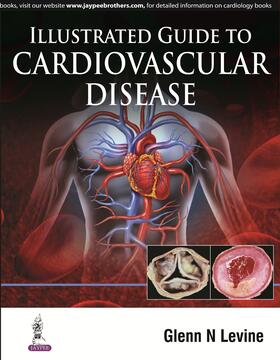 Levine |  Illustrated Guide to Cardiovascular Disease | Buch |  Sack Fachmedien