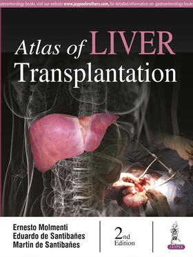 Santibanes / Molmenti / Santibañes | Atlas of Liver Transplantation | Buch | 978-93-5152-944-6 | sack.de