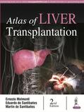 Santibanes / Molmenti / Santibañes |  Atlas of Liver Transplantation | Buch |  Sack Fachmedien