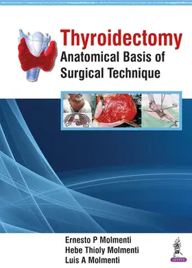 Molmenti |  Thyroidectomy | Buch |  Sack Fachmedien