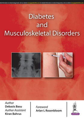 Basu | Diabetes and Musculoskeletal Disorders | Buch | 978-93-5270-024-0 | sack.de