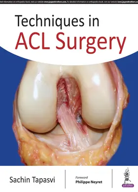 Tapasvi |  Techniques in ACL Surgery | Buch |  Sack Fachmedien