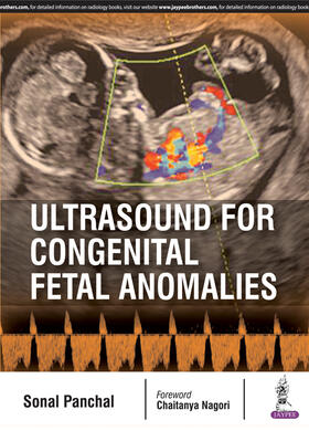Panchal |  Ultrasound for Congenital Fetal Anomalies | Buch |  Sack Fachmedien