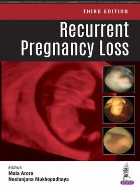 Arora / Mukhopadhaya | Recurrent Pregnancy Loss | Buch | 978-93-5270-091-2 | sack.de