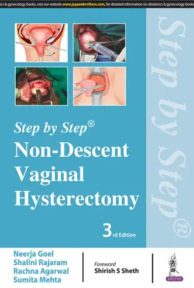 Goel / Rajaram / Agarwal |  Step by Step: Non-Descent Vaginal Hysterectomy | Buch |  Sack Fachmedien
