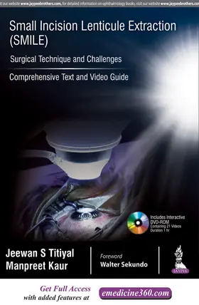 Titiyal / Kaur |  Small Incision Lenticule Extraction (SMILE): Surgical Technique and Challenges | Buch |  Sack Fachmedien