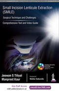 Titiyal / Kaur |  Small Incision Lenticule Extraction (SMILE): Surgical Technique and Challenges | Buch |  Sack Fachmedien