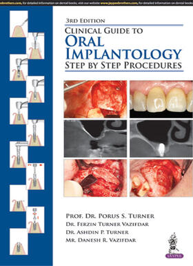 Turner / Vazifdar | Clinical Guide to Oral Implantology | Buch | 978-93-5270-427-9 | sack.de