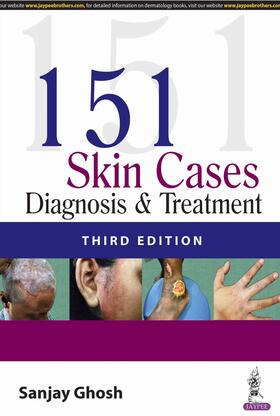Ghosh | 151 Skin Cases | Buch | 978-93-5270-492-7 | sack.de