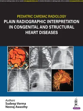 Verma / Awasthy | Pediatric Cardiac Radiology | Buch | 978-93-5465-352-0 | sack.de