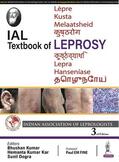 Kumar / Kar / Dogra |  IAL Textbook of Leprosy | Buch |  Sack Fachmedien