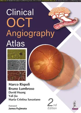 Rispoli / Lumbroso / Huang |  Clinical OCT Angiography Atlas | Buch |  Sack Fachmedien