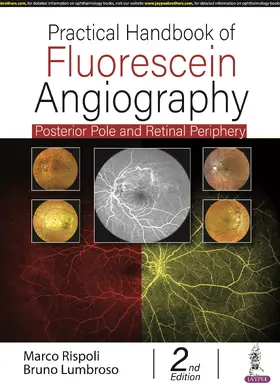 Rispoli / Lumbroso |  Practical Handbook of Fluorescein Angiography | Buch |  Sack Fachmedien