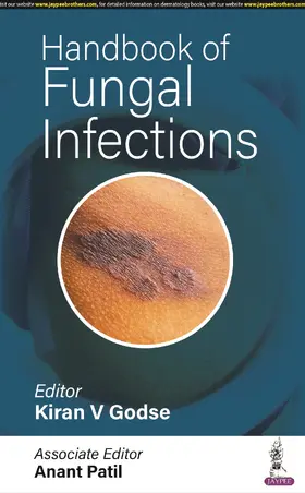 Godse / Patil |  Handbook of Fungal Infections | Buch |  Sack Fachmedien