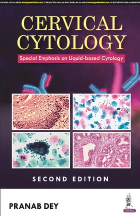Dey |  Cervical Cytology | Buch |  Sack Fachmedien
