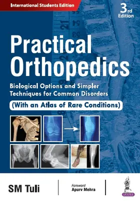 Tuli |  Practical Orthopedics | Buch |  Sack Fachmedien