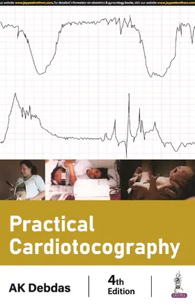 Debdas |  Practical Cardiotocography | Buch |  Sack Fachmedien