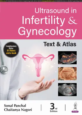 Panchal / Nagori |  Ultrasound in Infertility & Gynecology | Buch |  Sack Fachmedien