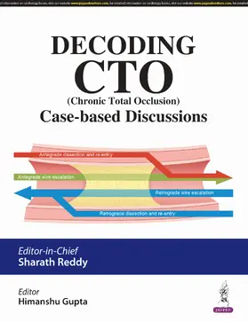 Reddy / Gupta |  Decoding CTO (Chronic Total Occlusion) | Buch |  Sack Fachmedien