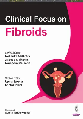 Malhotra / Saxena / Jamal |  Clinical Focus on Fibroids | Buch |  Sack Fachmedien