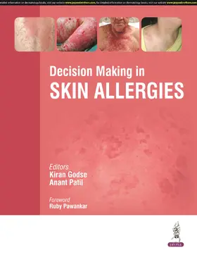 Godse / Patil |  Decision Making in Skin Allergies | Buch |  Sack Fachmedien